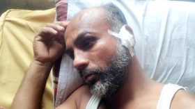 যুবলীগ নেতার লোকজনের মারধরে যুবদল কর্মী আহত