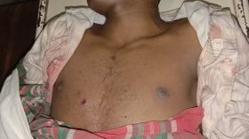 বরিশালে গোলাগুলিতে মাদক ব্যবসায়ী নিহত