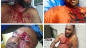 আবারও সন্ত্রাসী আল আমিন বাহিনীর হামলায় আহত ৬
