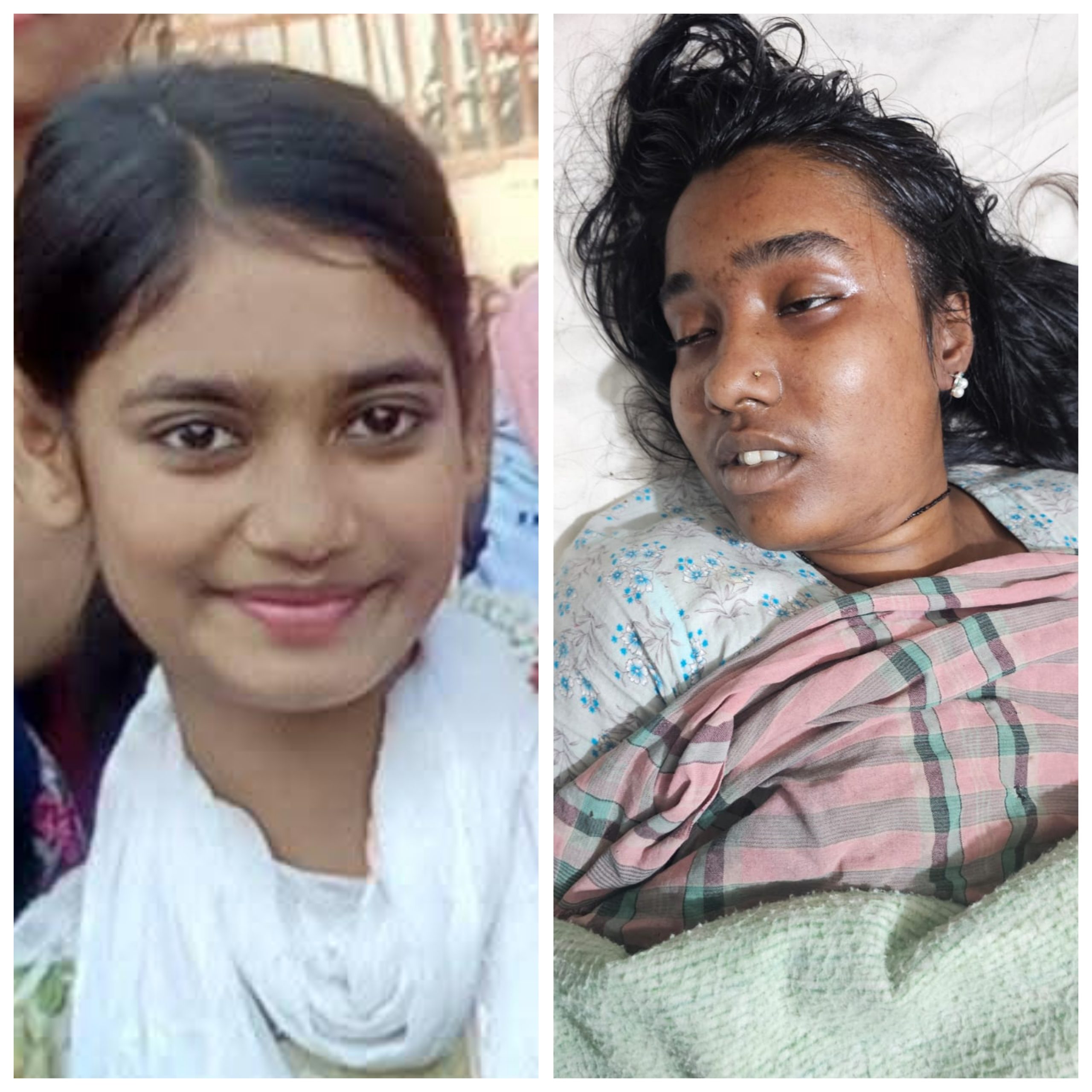 বরিশালে এসএসসিতে ফেল করায় দুই শিক্ষার্থীর আত্মহত্যা, একজনের চেষ্টা