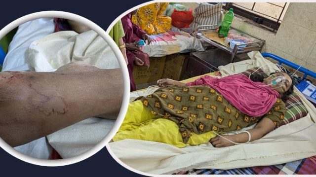 পটুয়াখালীতে রান্নাঘরে সাপের কামড়ে প্রাণ গেলো নারীর