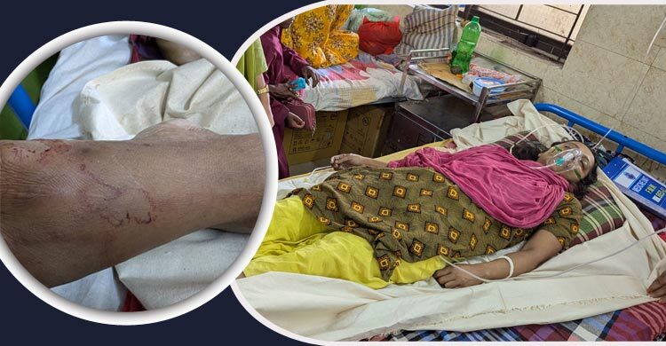 পটুয়াখালীতে রান্নাঘরে সাপের কামড়ে প্রাণ গেলো নারীর