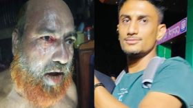 গৌরনদীতে গৃহকর্তার চোখে খোচা দিয়ে পালালো চোর
