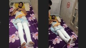 স্কুল শিক্ষককে পিটিয়ে দুই পা ভেঙে দেওয়ার অভিযোগ