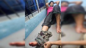 ডাকাতের গুলিতে বাড়ির মালিক গুলিবিদ্ধ, আটক ৩