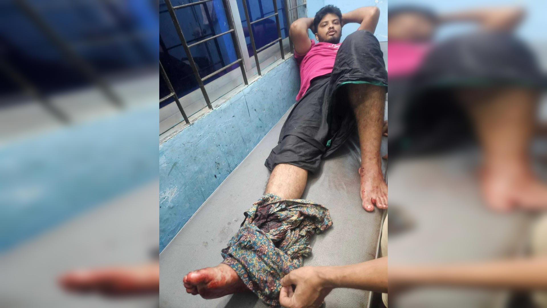ডাকাতের গুলিতে বাড়ির মালিক গুলিবিদ্ধ, আটক ৩
