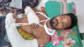 বাবুগঞ্জে জমি নিয়ে বিরোধের জেরে যুবককে কুপিয়ে জখম