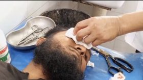 কলাপাড়ায় ব্যবসায়ীদের দুই গ্রুপে দু’দফা সংঘর্ষে আহত ১০
